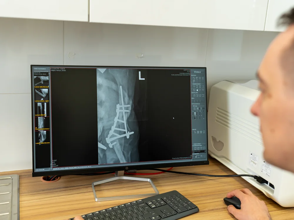 Zdjęcie RTG kręgosłupa psa z zespoleniem na monitorze pracowni